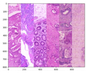 Chromatic normalization examples in stained colon sections